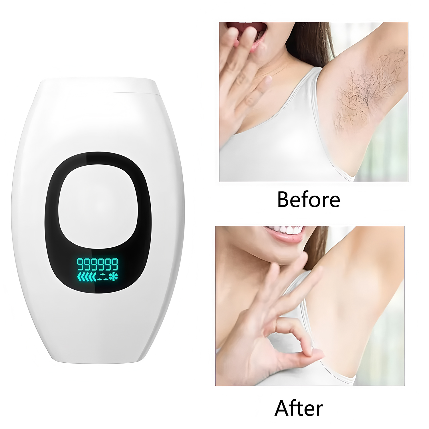 Beauty Care IPL Hair Removal D – From Home Hair Care Bewertung und Preis