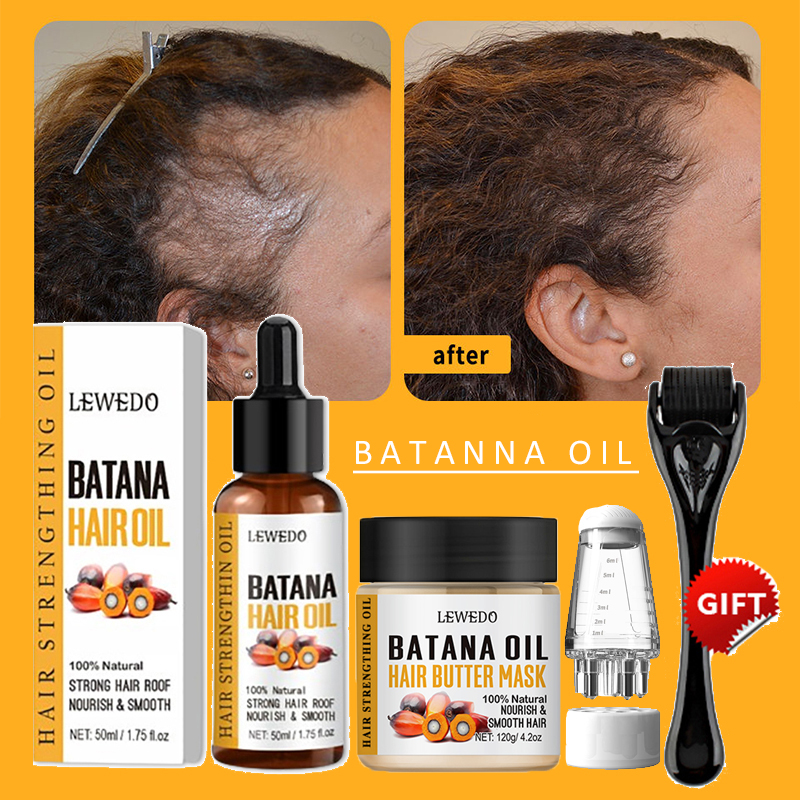 Batana Oil Hair Growth Kit Tra – Keratin Treatment Set Bewertung und Preis