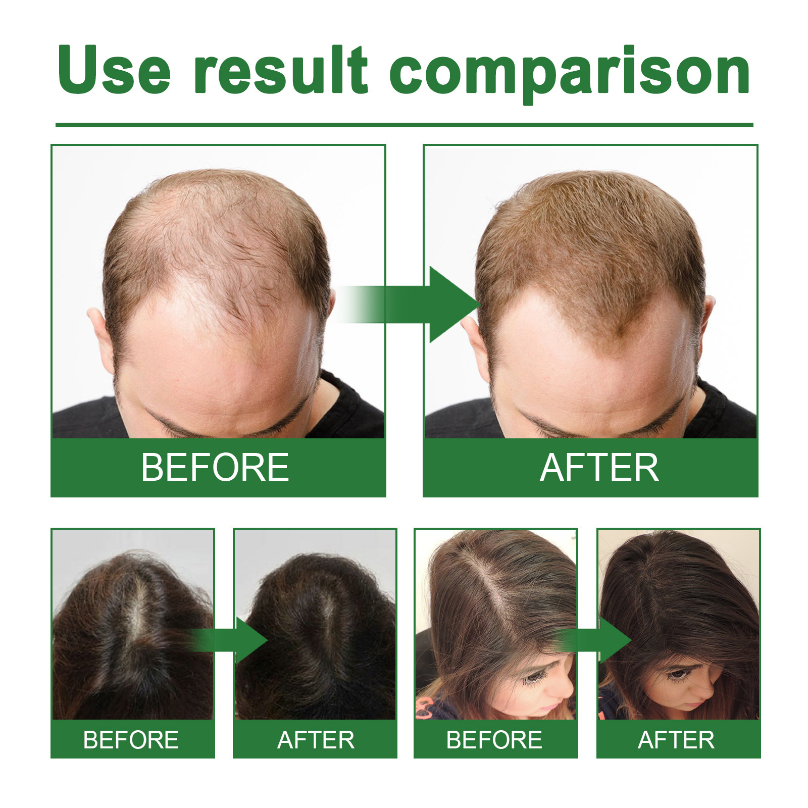 Rosemary Spray for Hair Nouris – Hair Care Natur Bewertung und Preis
